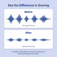 SleepHue™ PRO – Dual-Pulse Anti-Snoring Device